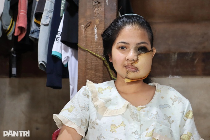 Dak Lak schoolgirl receives support from Dantri readers - 1