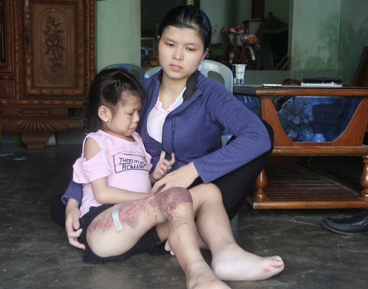 Little girl struggles to survive against cancer - 1 Little girl struggles to survive against cancer - 1