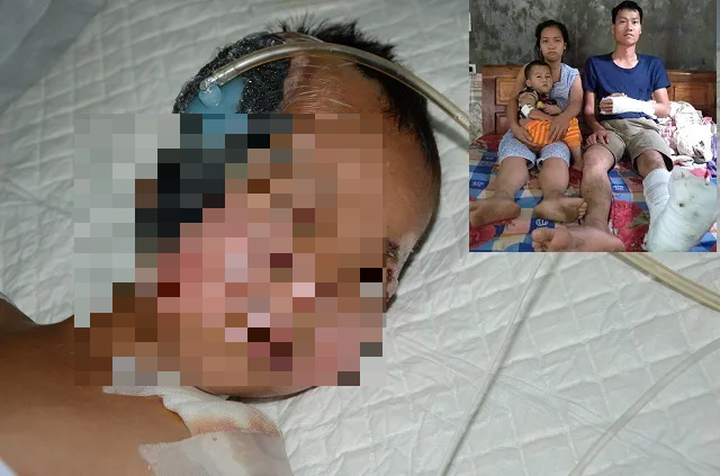 5-year-old boy suffers severe injuries after truck accident - 1