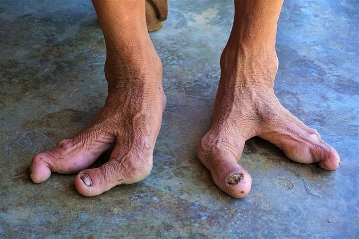 Disabled Kien Giang family thrive despite disadvantages - 2