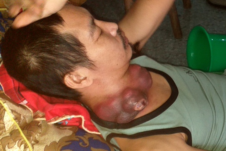 Poor man on verge of death in dire need of help - 1