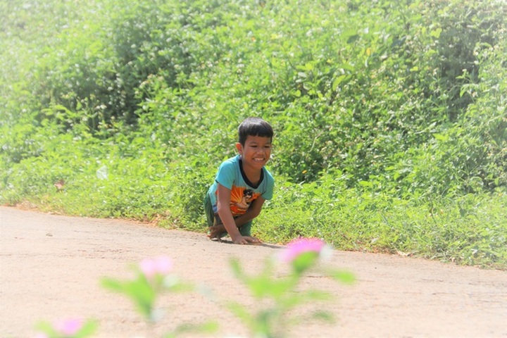 Little boy with deformed legs in need of support - 1 Little boy with deformed legs in need of support - 1