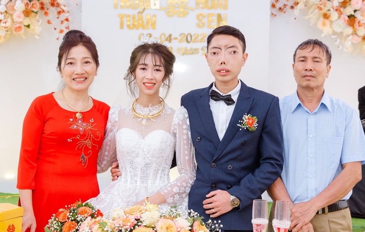 Man enjoys life after being saved from large facial tumour - 3 Man enjoys life after being saved from large facial tumour - 3