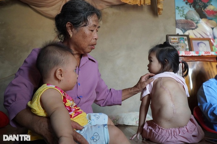 Little girl facing big tumours in dire need of support - 2