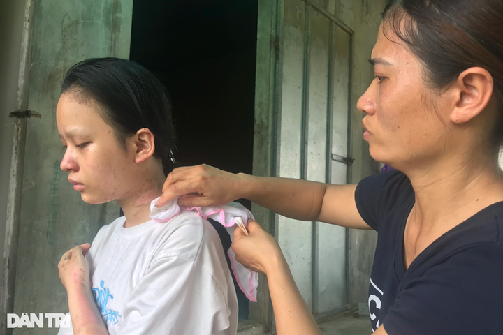 Ailing family in Nghe An calls for help - 1