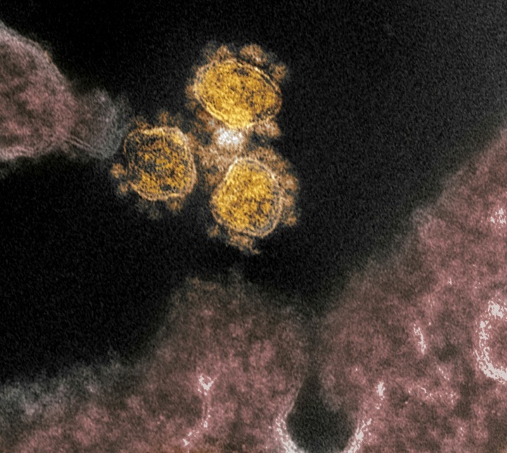 Six-week-old newborn dies of coronavirus in US: state governor - 1 Six-week-old newborn dies of coronavirus in US: state governor - 1