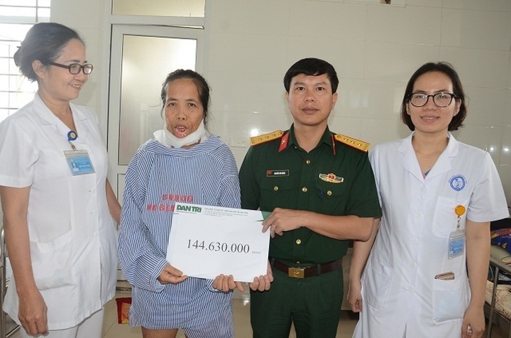 Woman suffering from horrific facial burns has life-transforming operation - 4 Woman suffering from horrific facial burns has life-transforming operation - 4