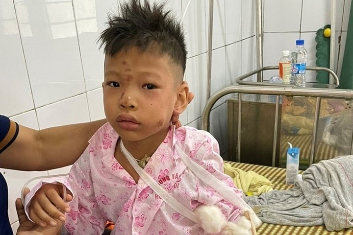 Two dead, one injured in Hoa Binh landslide - 1