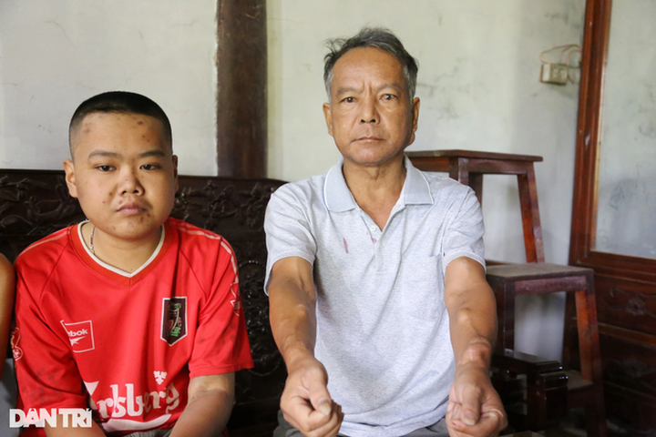 Poor Ha Tinh family receives support to treat four ill members - 2