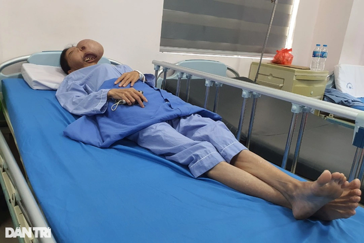 Woman with distorted face seeks help - 1 Woman with distorted face seeks help - 1