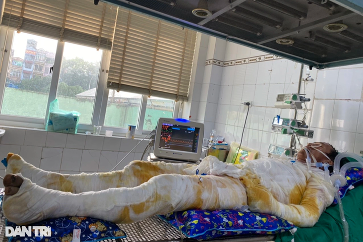 Seriously-burnt man in desperate need of support - 1 Seriously-burnt man in desperate need of support - 1