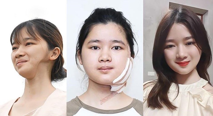 Challenging cosmetic surgery makes a name for PhD. MD. Richard Huy - 2 Challenging cosmetic surgery makes a name for PhD. MD. Richard Huy - 2