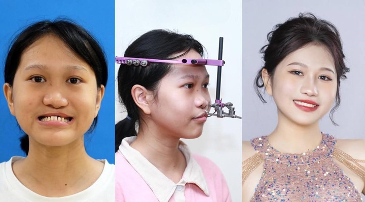 Challenging cosmetic surgery makes a name for PhD. MD. Richard Huy - 3 Challenging cosmetic surgery makes a name for PhD. MD. Richard Huy - 3