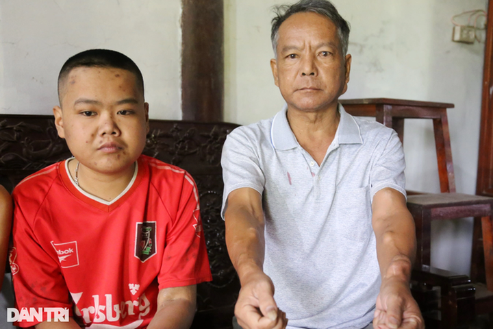 Poor woman in Ha Tinh aims to save ailing husband and son - 2