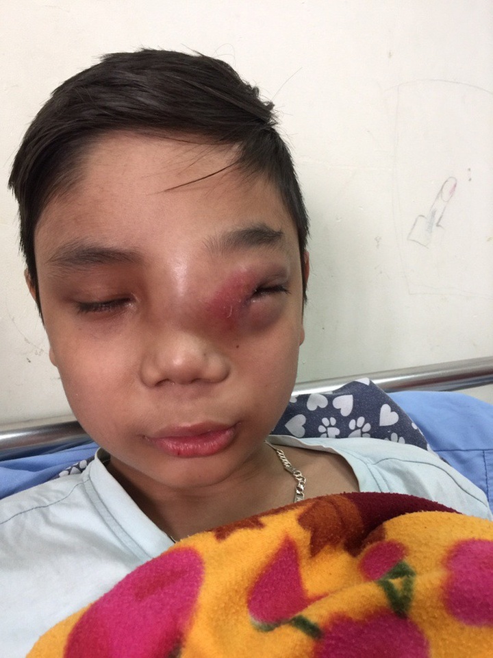 12-year-old boy desperately fights against lymphoma - 1 12-year-old boy desperately fights against lymphoma - 1