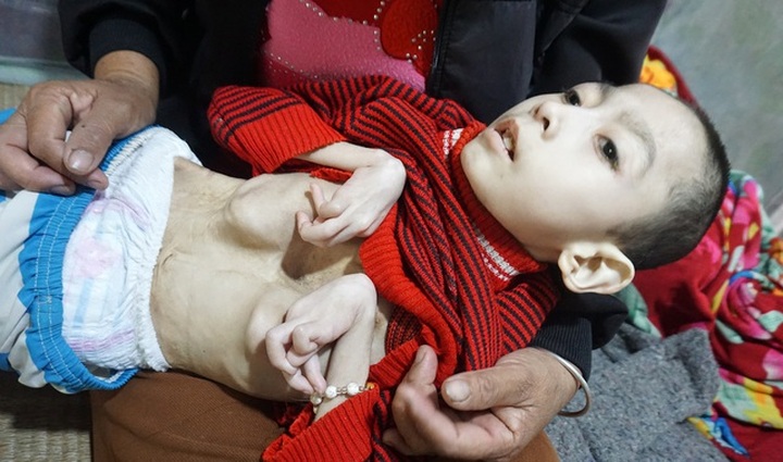 Mother wants to give cerebral-palsy son a better life - 2