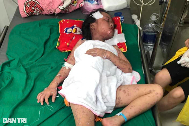 Nghe An girl facing rare disease in dire need of support - 1