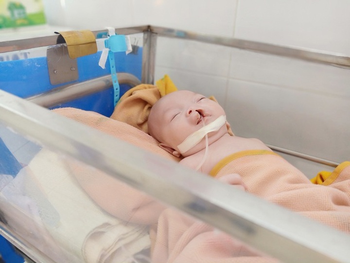 Abandoned infant needs cleft palate surgery - 1
