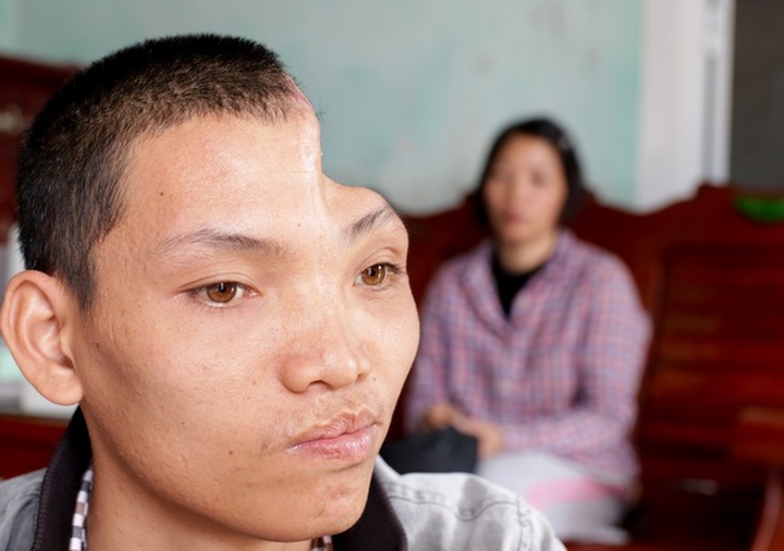 Poor man to get surgery thanks to support - 1