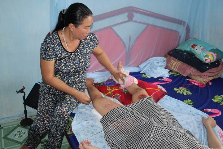 Young woman needs support to recover from serious injury - 2 Young woman needs support to recover from serious injury - 2