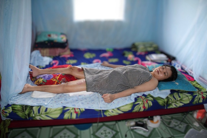 Young woman needs support to recover from serious injury - 1 Young woman needs support to recover from serious injury - 1