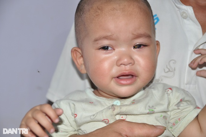 Poor ethnic minority couple call for help to save daughter from retinoblastoma - 1