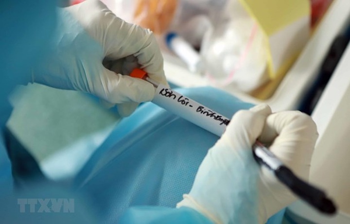 About 30 labs in Vietnam capable of testing for COVID-19 - 1 About 30 labs in Vietnam capable of testing for COVID-19 - 1