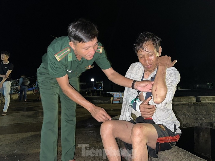 Quang Ngai fishermen attacked by Chinese Coast Guards - 2 Quang Ngai fishermen attacked by Chinese Coast Guards - 2