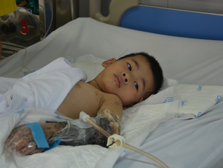 Six-year-old boy could lose limb after traffic accident - 1