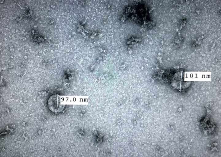 Vietnam successfully isolates new coronavirus: health official - 1 Vietnam successfully isolates new coronavirus: health official - 1