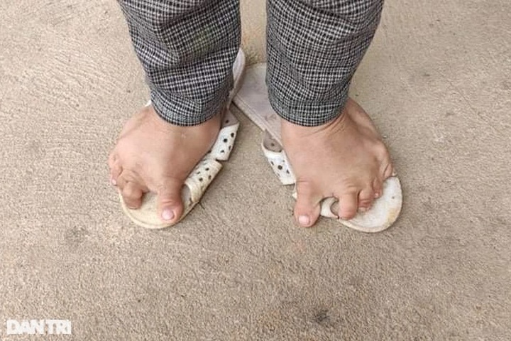 Little girl facing big tumours in dire need of support - 3