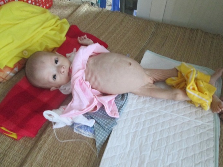 Six month-old baby struggling for life - 1