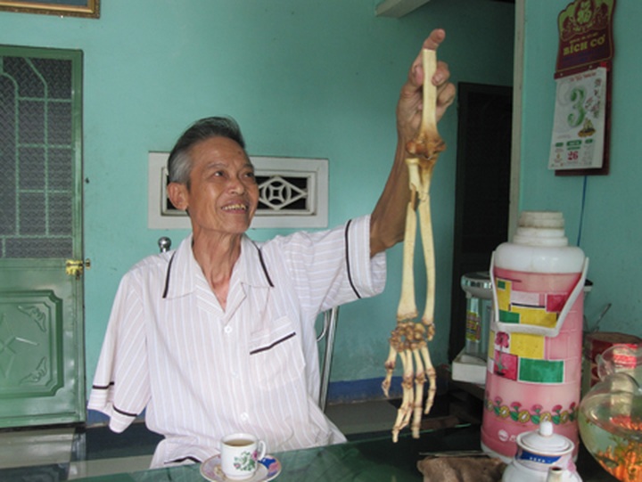 Vietnamese veteran regains amputated arm - 1