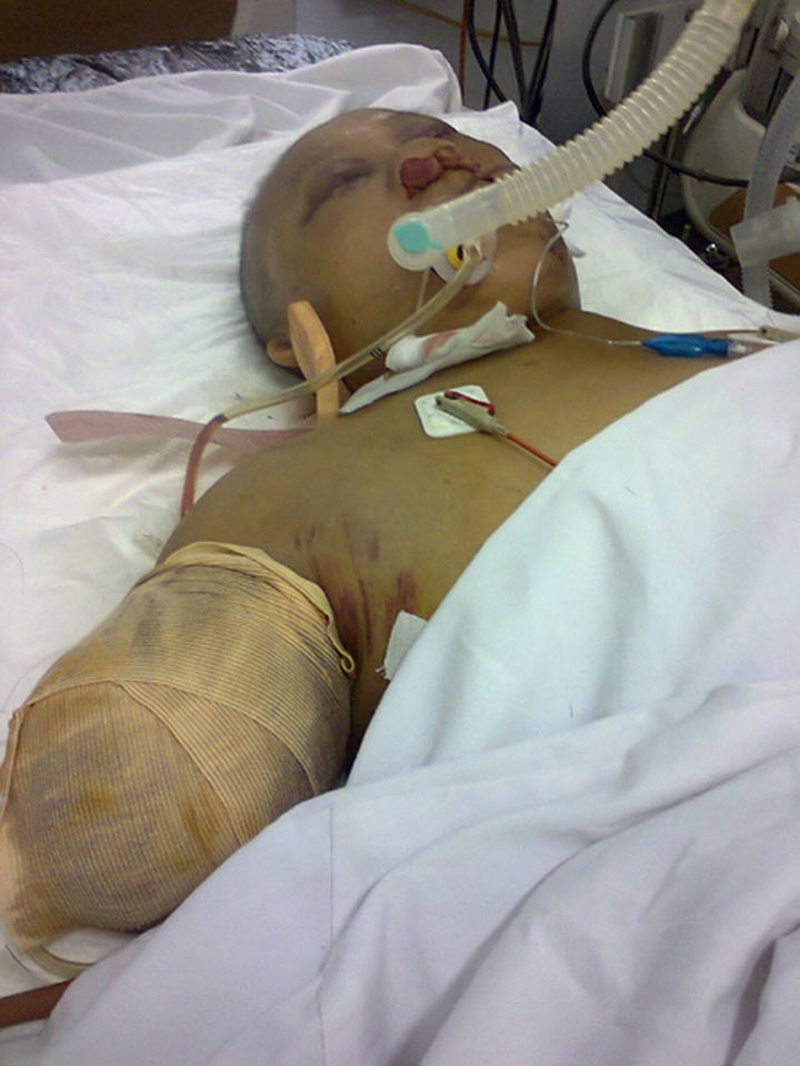 Family of dioxin victims in desperate need of help - 2