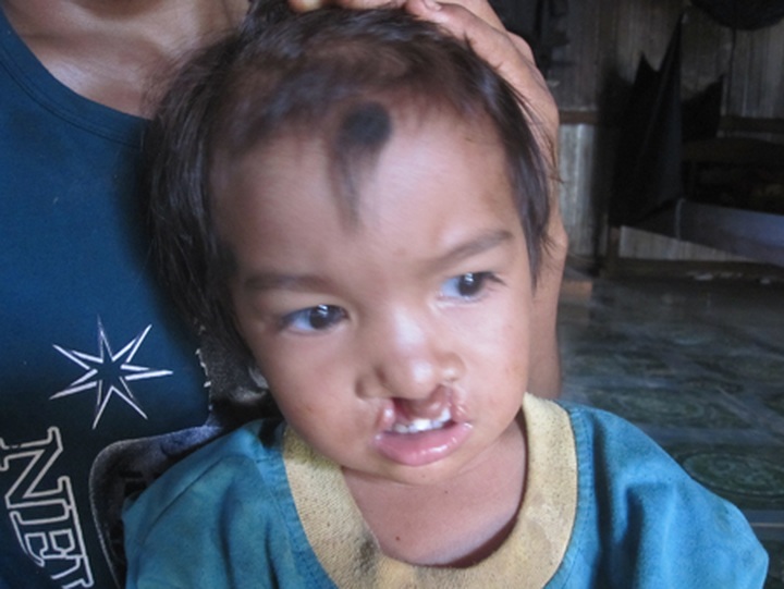 Ethnic J'Rai couple need help for disabled daughter - 1 Ethnic J'Rai couple need help for disabled daughter - 1