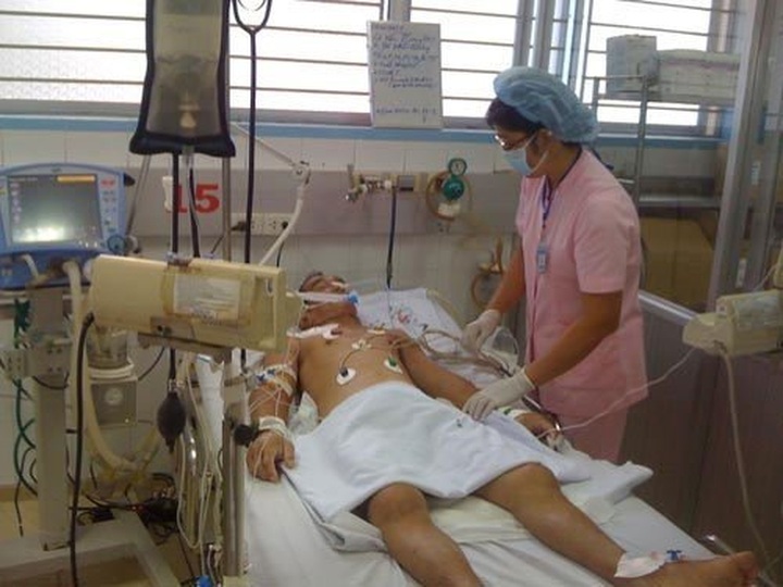 Over 50 percent of H5N1 patients die - 1