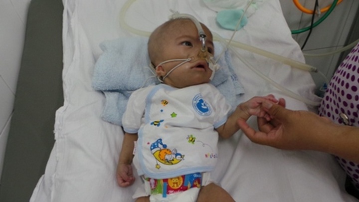 9-month old baby fights for his life - 1