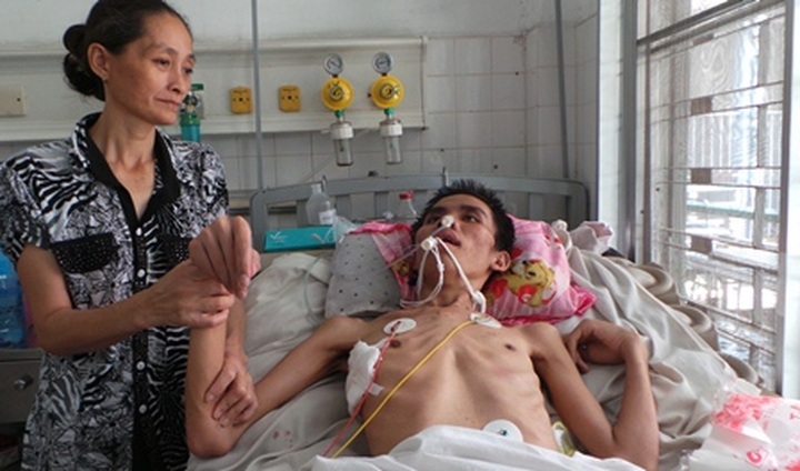 Young man with acute nerve inflammation in desperate fight for survival - 1