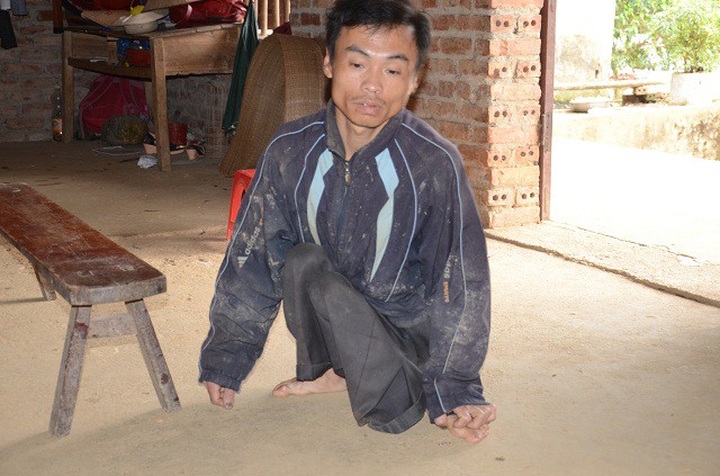Disabled father struggles to raise ill daughter and wife - 1