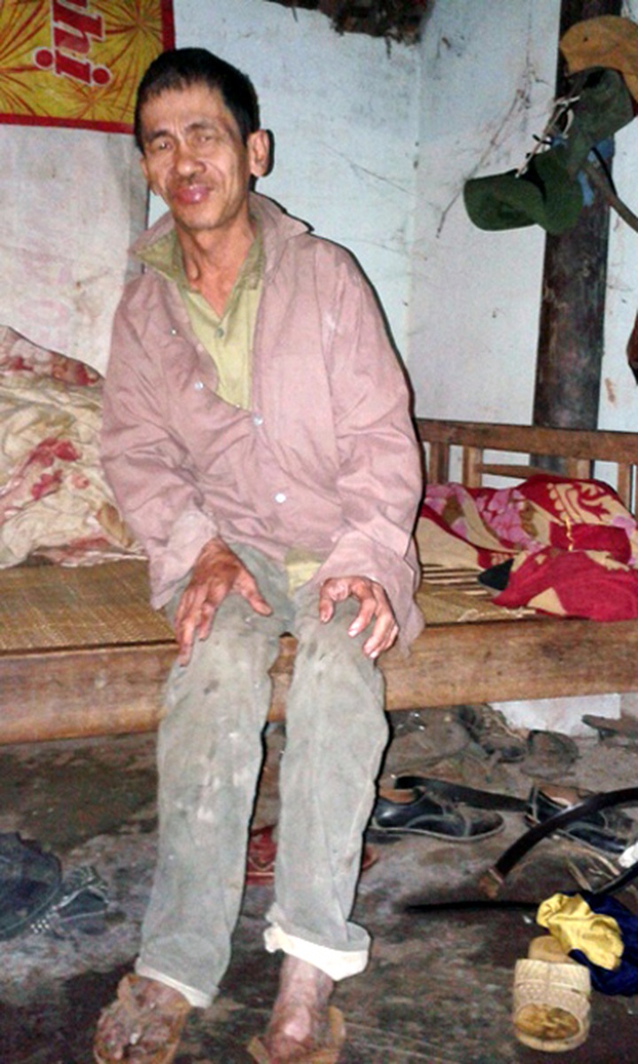 Poor, ailing man wishes for a decent meal - 1