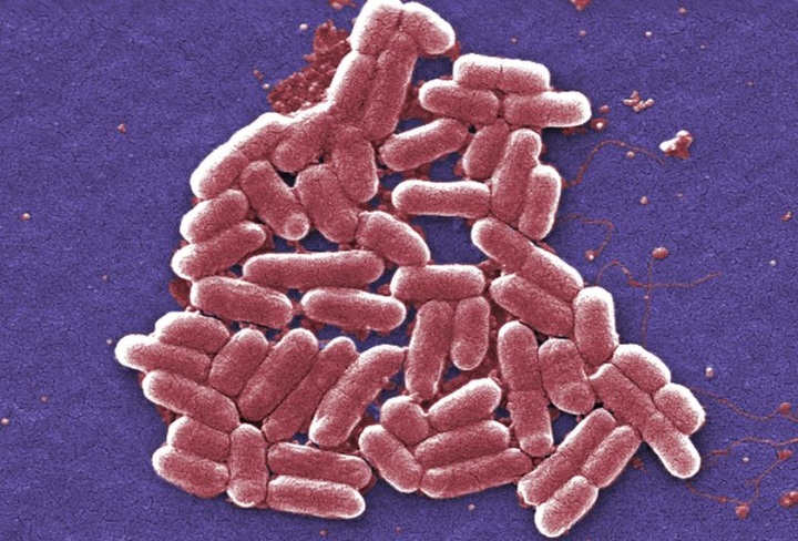 Study: Superbug infections found in Chinese hospitals - 1