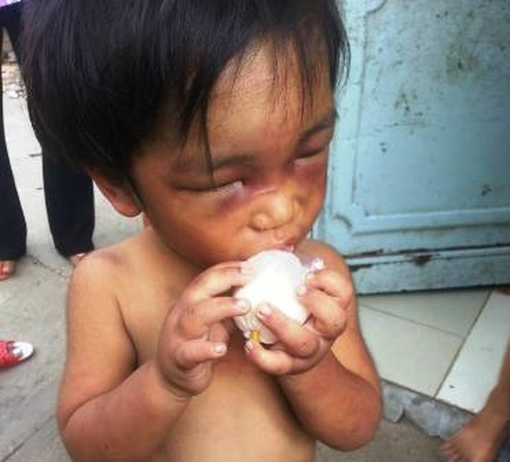 Three-year-old boy brutally abused by uncle - 1