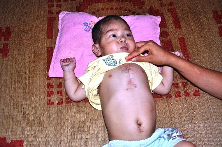 Poor couple powerless to save small son - 1 Poor couple powerless to save small son - 1