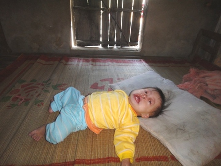 13-month-old baby plagued by serious diseases - 2