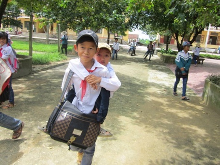 Brittle-bone boy faces life with strength - 3 Brittle-bone boy faces life with strength - 3