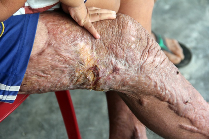 Little girl looks after seriously ill father - 2 Little girl looks after seriously ill father - 2