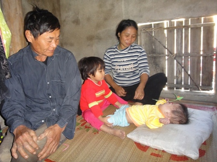 13-month-old baby plagued by serious diseases - 1