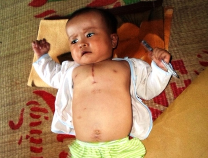 Poor mother powerless to see child facing death - 1