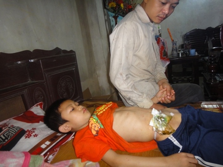 Abandoned boy in Ha Tinh struggles with disease - 1 Abandoned boy in Ha Tinh struggles with disease - 1