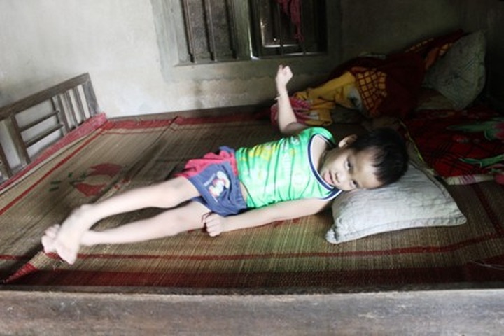 Little boy struggles with cerebral palsy - 1